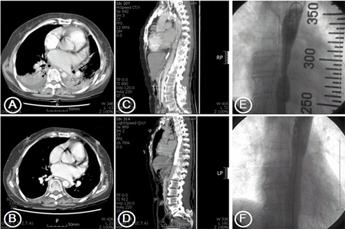 Chest+ct+scan+images
