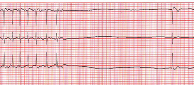 case_32_s_2.jpg